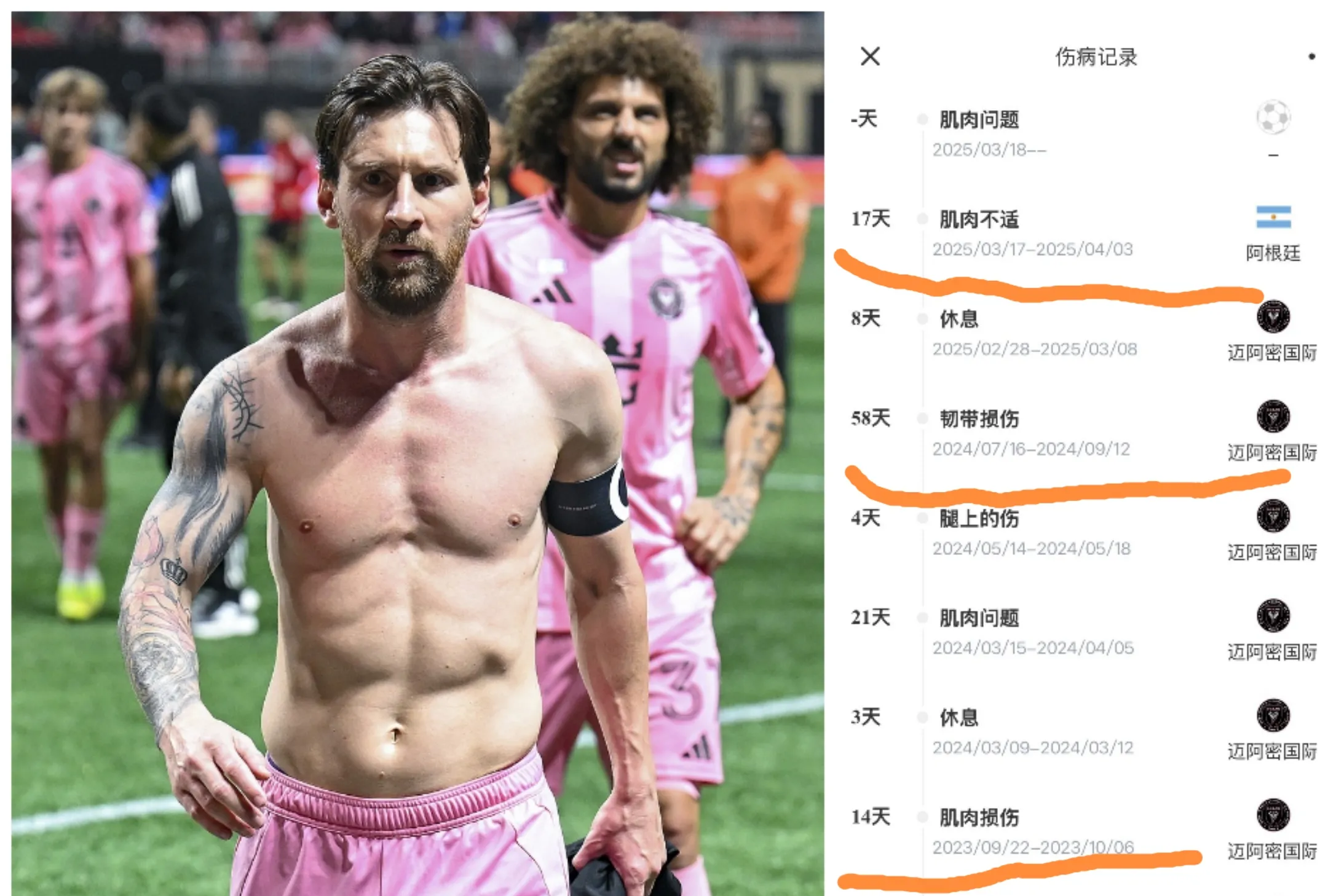 梅斯球员因伤长时间休战，俱乐部或需替补